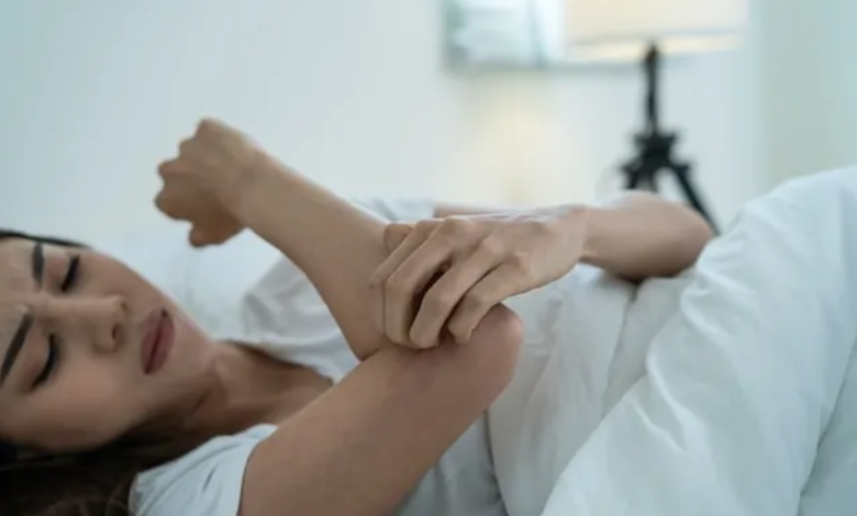 The Biology Behind Bed Bug Symptoms and Human Reactions